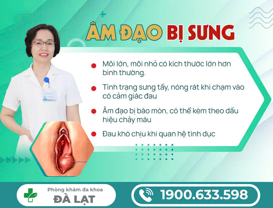 Hình ảnh minh họa
